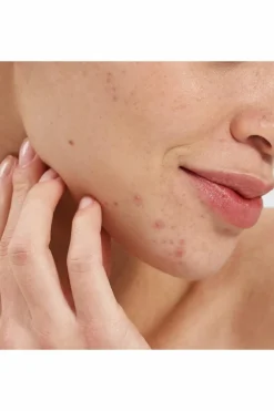 Sale Booster purifiant  à l’acide salicylique Sérum & Huile