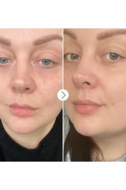 Hot Huile visage universelle Rosehip BioRegenerate Sérum & Huile