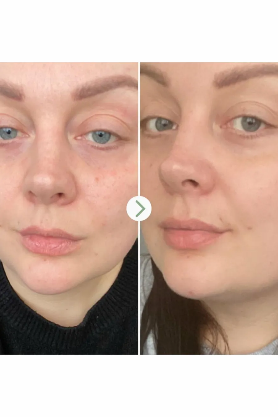Hot Huile visage universelle Rosehip BioRegenerate Sérum & Huile