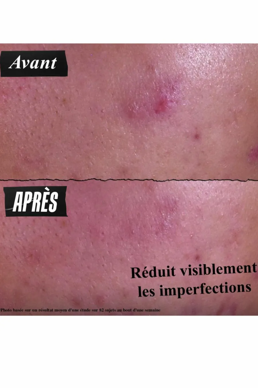 Clearance Pâte Anti-Imperfections 3-en-1 Démaquillant Visage