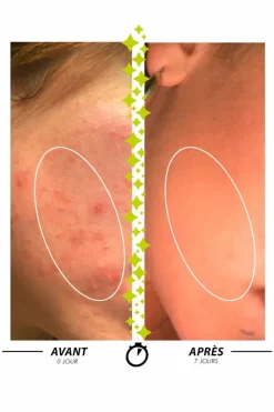 Clearance Pâte purifiante anti-imperfections Sulfureuse Pâte du Marabout Anti-Imperfection & Rougeurs|Nettoyant Visage